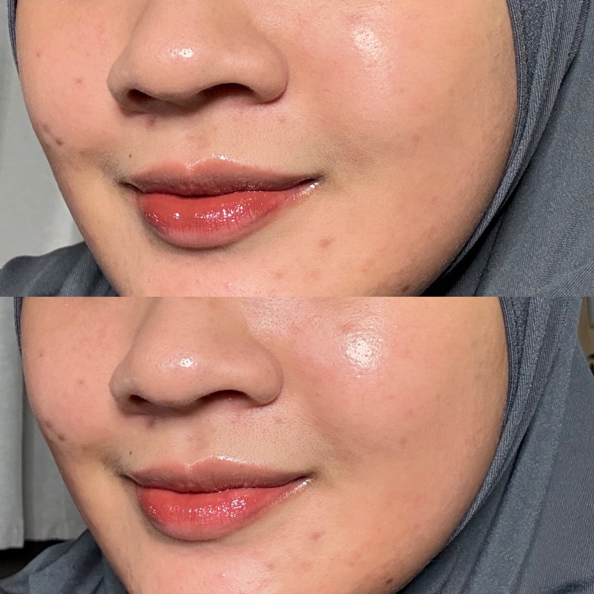 gais, kalian suka ngerasa gak kulit ttp kusam pdhl udah pake brightening serum? bisa jadi karena dehidrasi loh.... 

liattt yg bawah kulitku lebih lembap jd keliatan lebih seger dan hidup🥲✨✨