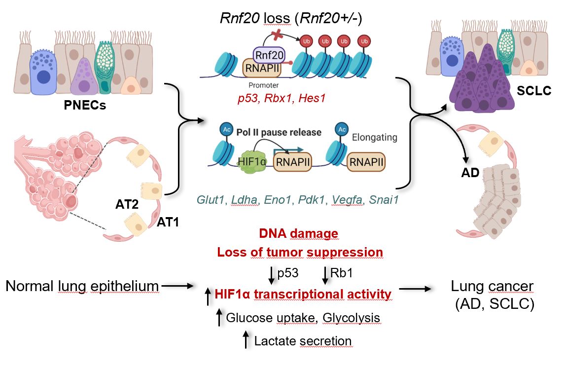 DobrevaLab's tweet image. We are excited to share our latest work uncovering how the epigenetic modifier RNF20 links genome stability and metabolic rewiring in lung cancer: @NatureComms rdcu.be/en5Ps