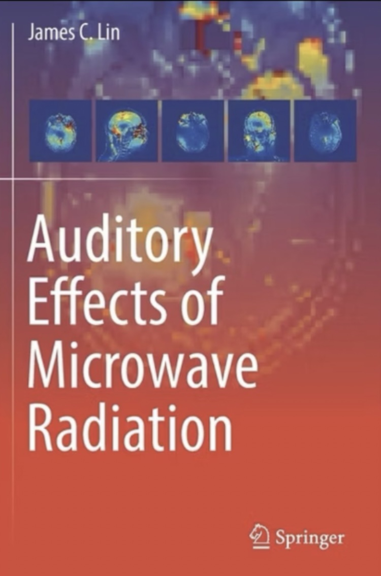 Does V2K need an implant chip to work?  

No!
Read the college textbook by Professor James Lin - “Auditory Effects of Microwave Radiation”

Even deaf people can hear V2K.