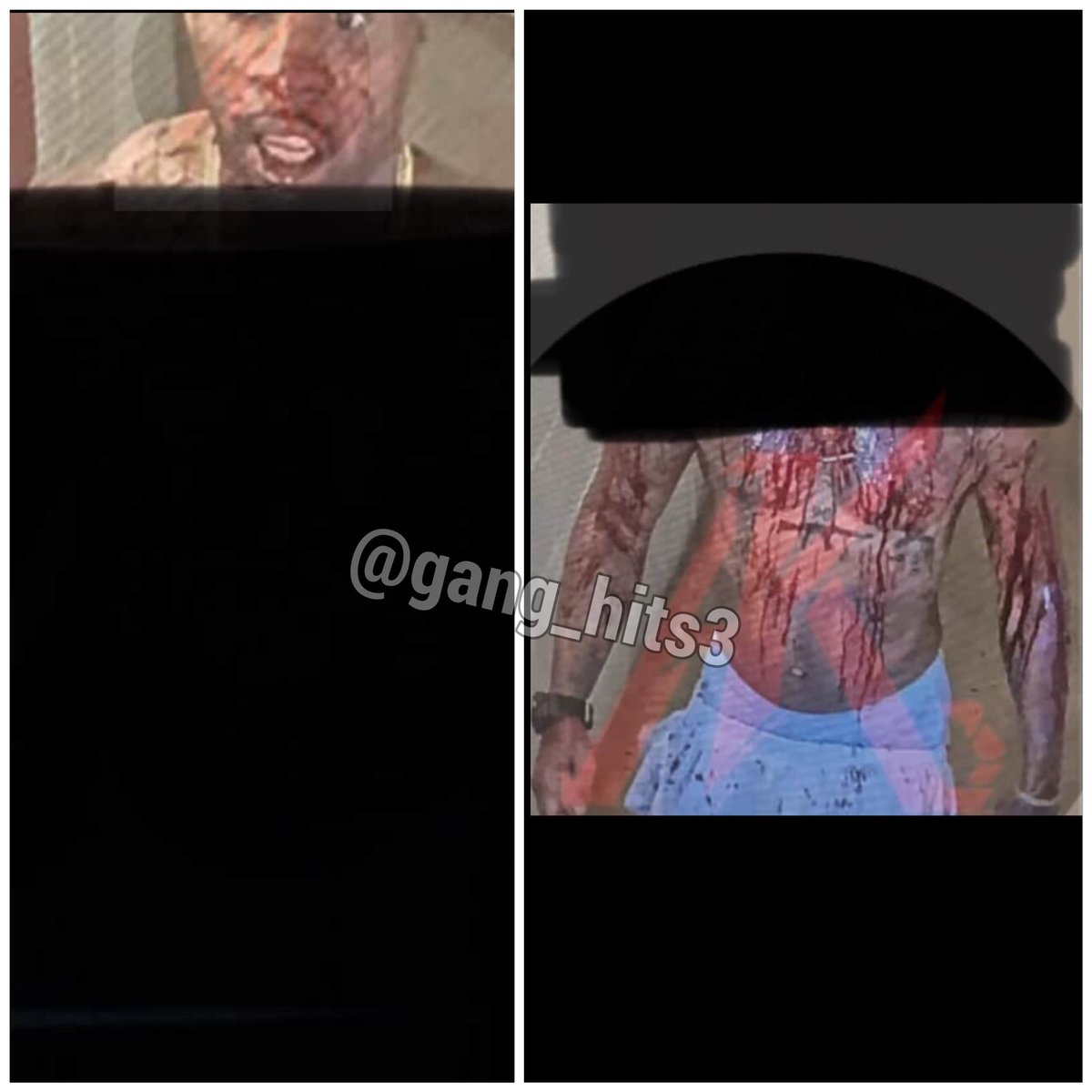 GangHits's tweet photo. Footage of Tory Lanez brutal stabbing 
🔪 🩸 https://t.co/cfiQOjBw2Z