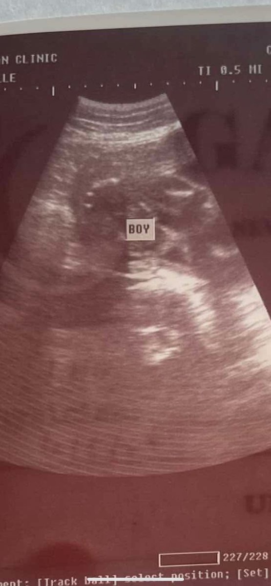 TYL it’s a Baby Boy 💙 see sa august baby David Lauren 🥰🥹 oo si #DavidLicauco ang pinag lihihan ko 😜 pero syempre nandyan pa din name ng husband ko🥰 #BabyBoy