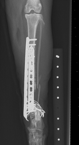 Challenging case? We'd love to have some of you share your challenging revision cases with us in Bristol. Can be anonymous if required ;-) More details here bvoa.co.uk/events/bvoa-au…