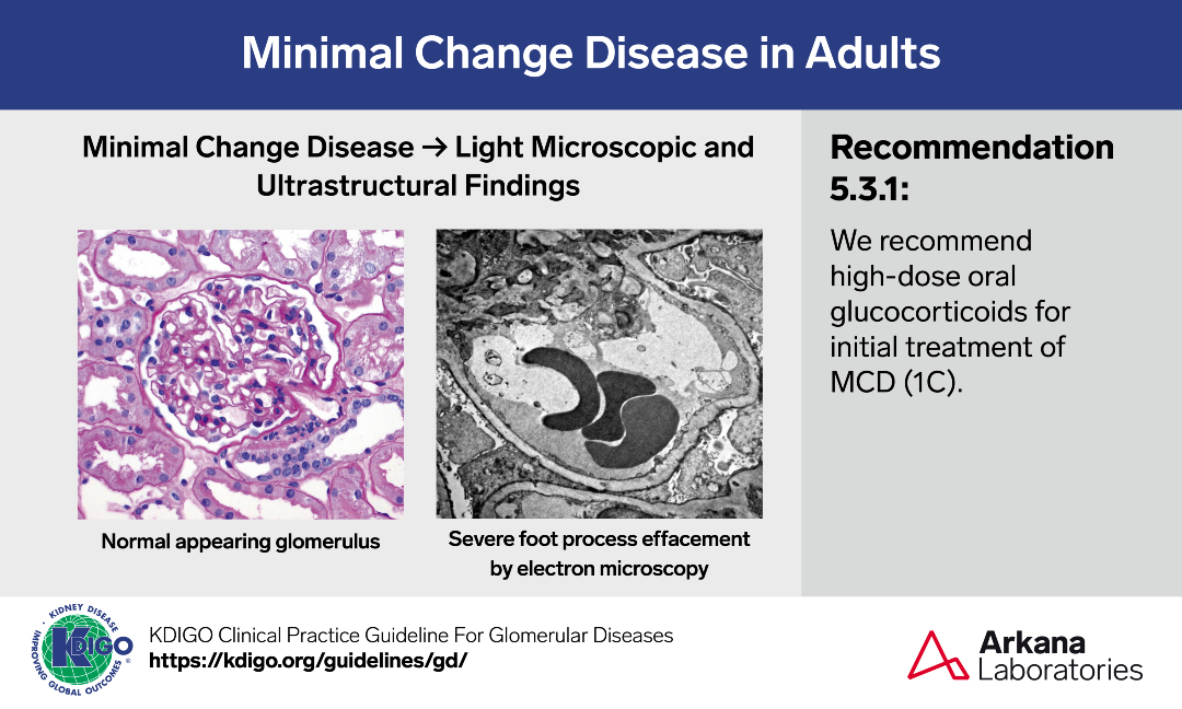 A sample from the pathology teaching slide set on Minimal Change Disease in Adults, jointly prepared by Arkana Laboratories and <a href="/goKDIGO/">KDIGO</a>. KDIGO.org/guidelines/gd/

#KDIGO #pathology #kidneypath #renal