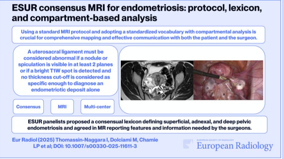 Ana Villanueva (@anavillanuevaca) on Twitter photo 📣Hot off the press. Finally here!!!
💛 ESUR consensus MR for endometriosis 2025: protocol, lexicon, analysis
➡️Open access! Click here: link.springer.com/content/pdf/10…
<a href="/ESUR_JN/">ESUR Junior Network</a> <a href="/FOAMrad/">FOAMrad</a> <a href="/EurRadiology/">European Radiology</a> <a href="/SAR_RFS/">SAR Resident and Fellow Section</a> <a href="/sediabdomen/">SEDIA</a> #radres #meded #futureradres #endometriosis 📣Hot off the press. Finally here!!!
💛 ESUR consensus MR for endometriosis 2025: protocol, lexicon, analysis
➡️Open access! Click here: link.springer.com/content/pdf/10…
<a href="/ESUR_JN/">ESUR Junior Network</a> <a href="/FOAMrad/">FOAMrad</a> <a href="/EurRadiology/">European Radiology</a> <a href="/SAR_RFS/">SAR Resident and Fellow Section</a> <a href="/sediabdomen/">SEDIA</a> #radres #meded #futureradres #endometriosis