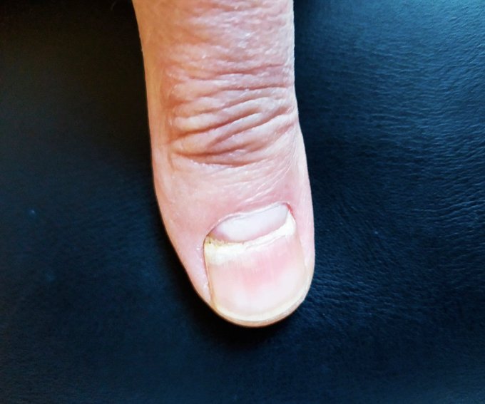 Image in tweet by Analyze & Optimize