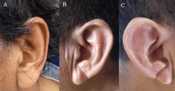 Image in tweet by Analyze & Optimize