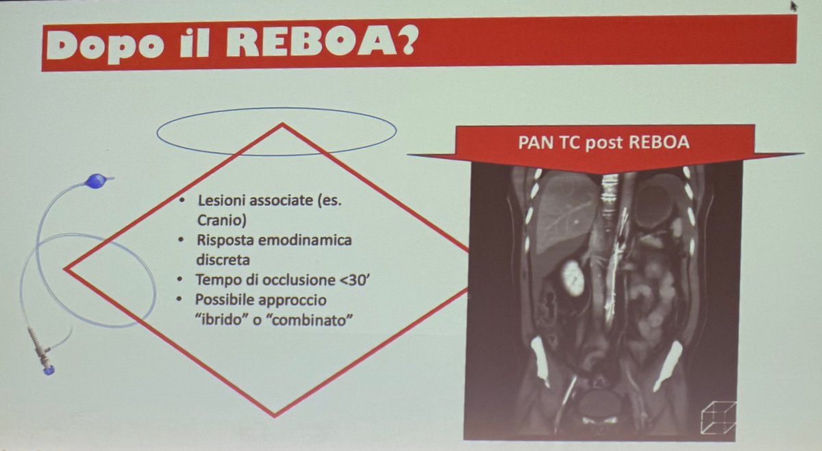 1st Biennale #simeu Bari 28-29 may 2025

REBOA use via Carlo Coniglio

⏱️ Remove &gt; 30 minutes

After REBOA

👩‍⚕️ Surgery

👉 Damage Control

☢️ Diagnostics