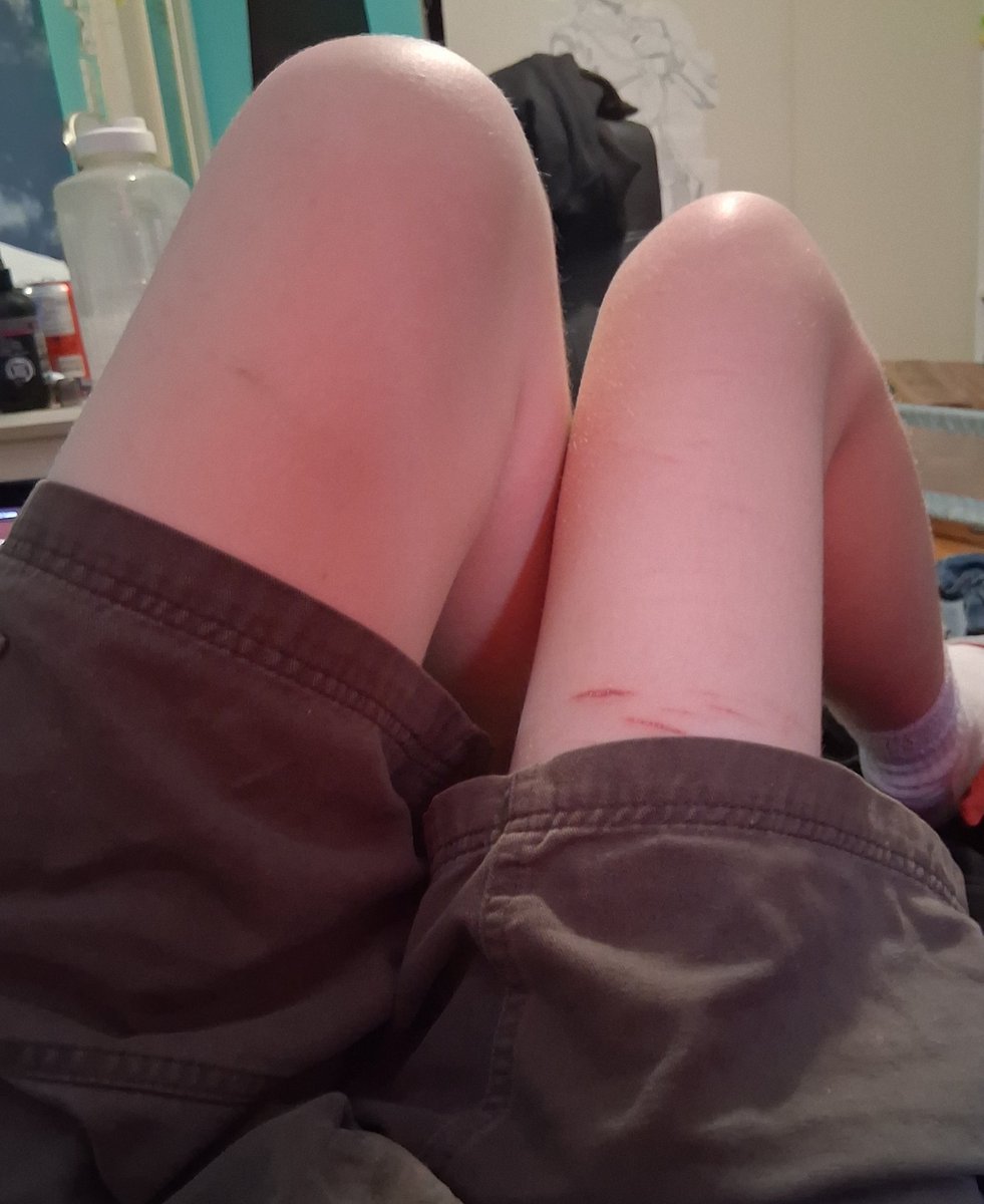 m0reOrgans's tweet photo. Guys this is ur sign to never trust what u see online bc why are my legs giving 2 separate sides of comparisonspo IN THE SAME PIC 😭 https://t.co/jE8mUGtjIv