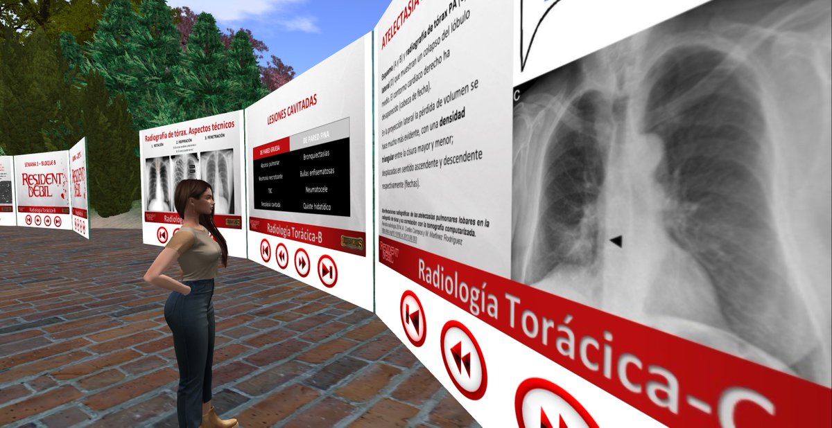 Francisco Sendra (@pakosendra) on Twitter photo #ResidentDebil 2025 sigue avanzando con 160 residentes de 7 países hispanohablantes.
Mira el avance y clasificación tras la primera semana: linkedin.com/posts/francisc… #Secondlife #radiologia <a href="/SERAM_RX/">SERAM - Sociedad Española de Radiología Médica</a> <a href="/residentesSERAM/">Residentes SERAM</a> <a href="/RadiologiaChile/">SOCHRADI</a> <a href="/FMRIoficial/">FMRI</a> <a href="/FAARDIT/">FAARDIT - Federación Argentina de Radiología</a> #ResidentDebil 2025 sigue avanzando con 160 residentes de 7 países hispanohablantes.
Mira el avance y clasificación tras la primera semana: linkedin.com/posts/francisc… #Secondlife #radiologia <a href="/SERAM_RX/">SERAM - Sociedad Española de Radiología Médica</a> <a href="/residentesSERAM/">Residentes SERAM</a> <a href="/RadiologiaChile/">SOCHRADI</a> <a href="/FMRIoficial/">FMRI</a> <a href="/FAARDIT/">FAARDIT - Federación Argentina de Radiología</a>