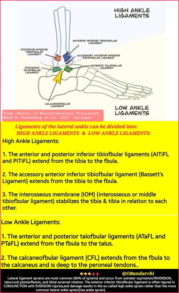 🛑Some authors devide the LATERAL ankle ligaments into high &amp; low based on the resultant sprain injury. For example ant. inf. tibiofibular lig often injured in conjunction with eversion injurie results in HIGH ankle sprain rather than more common lateral ankle sprain(low sprain)