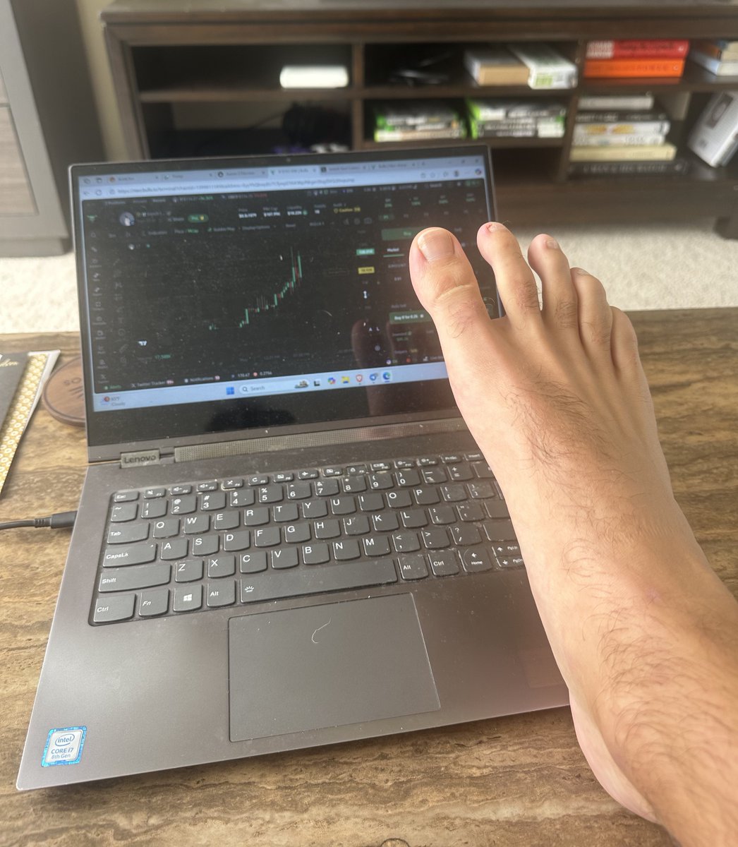 SlabzMcAllister's tweet photo. Doctor just told me that I need to stop clicking 

Awful case of $TF https://t.co/oTARq0Kr3H