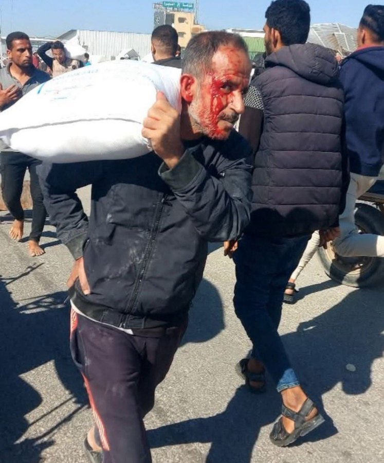Gazze'de kanlı yüzüyle un çuvalı taşıyan bir Filistinli..
