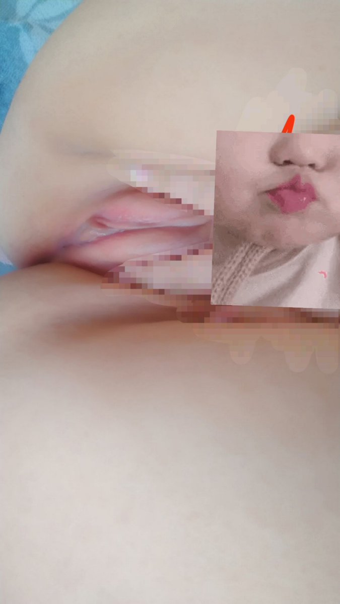 418 tweet media