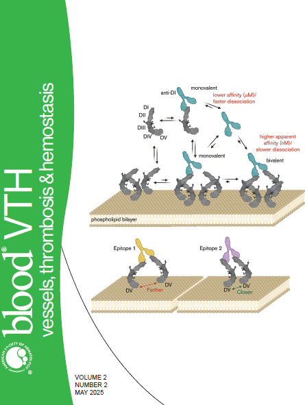 🚨New Blood Vessels, Thrombosis &amp; Hemostasis issue out now featuring:
Effects of sickle trait on maternal and perinatal outcomes among pregnant women ow.ly/jHyi50VZbPY