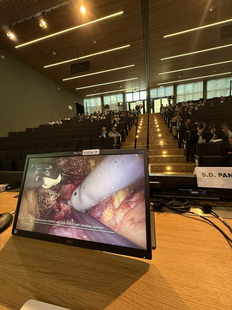 PandolfoSD's tweet image. Grateful to attend #IEA2025 โ honored to moderate with @ermannosegreto the live RAPN with @RoccoPapaliaUro with Hugo RAS. Outstanding surgery, great energy.
Inspired by the brilliant lectures of @VipPatelMD, @ricautor and @OTRAXER ๐๐
