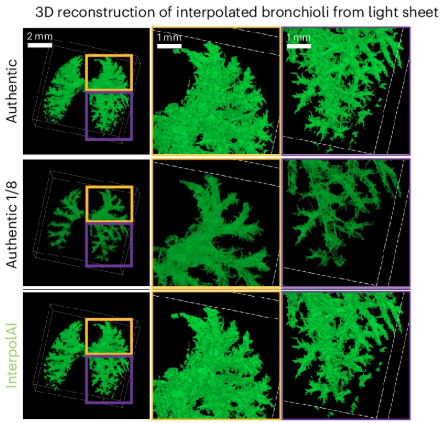 Nature Methods (@naturemethods) on Twitter photo Can a deep learning model know your data well enough to predict missing parts? InterpolAI accurately interpolates synthetic images between pairs of authentic images to “repair” tissue damage and reduce stitching artifacts across modalities. <a href="/deniswirtz/">Denis Wirtz</a> bit.ly/453o1i1 Can a deep learning model know your data well enough to predict missing parts? InterpolAI accurately interpolates synthetic images between pairs of authentic images to “repair” tissue damage and reduce stitching artifacts across modalities. <a href="/deniswirtz/">Denis Wirtz</a> bit.ly/453o1i1