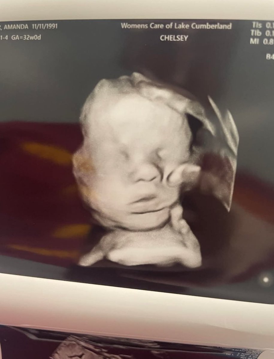 Amazing.

During an ultrasound, a mama sees what appears to be a hand gently resting on her unborn baby’s head—leading her to believe it was the hand of God.

“I’ve asked the Lord repeatedly to please keep His hand on my baby.”

Every child is God’s child, created for love.