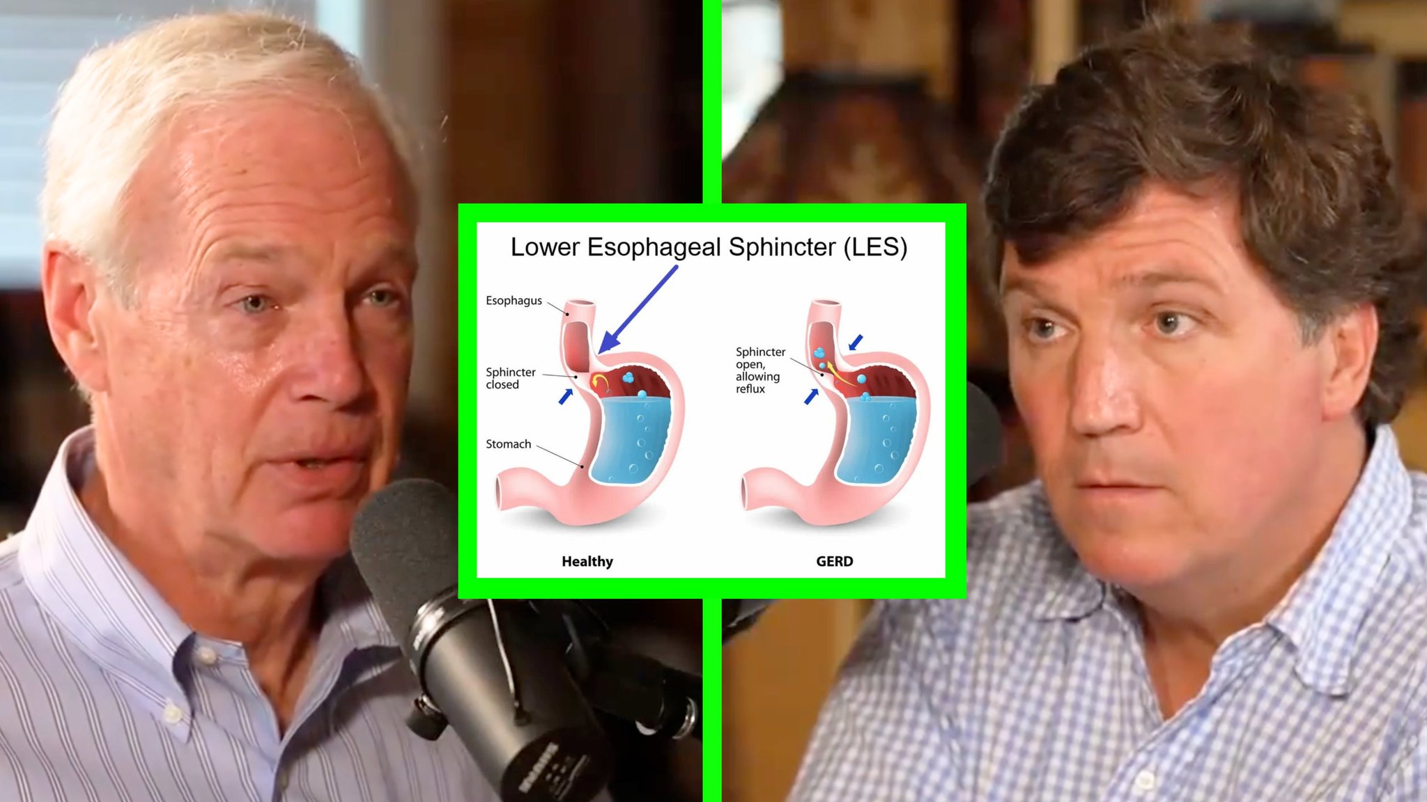 💥 Johnson参议员关于他汀类药物的个人服用经历其实比比皆是。他汀类药物的危害已经被不少有独立观察力和批判性思维的临床专业人士讨论。

💊 他汀类是一类降胆固醇药物,  第一种他汀类药物 Lo...