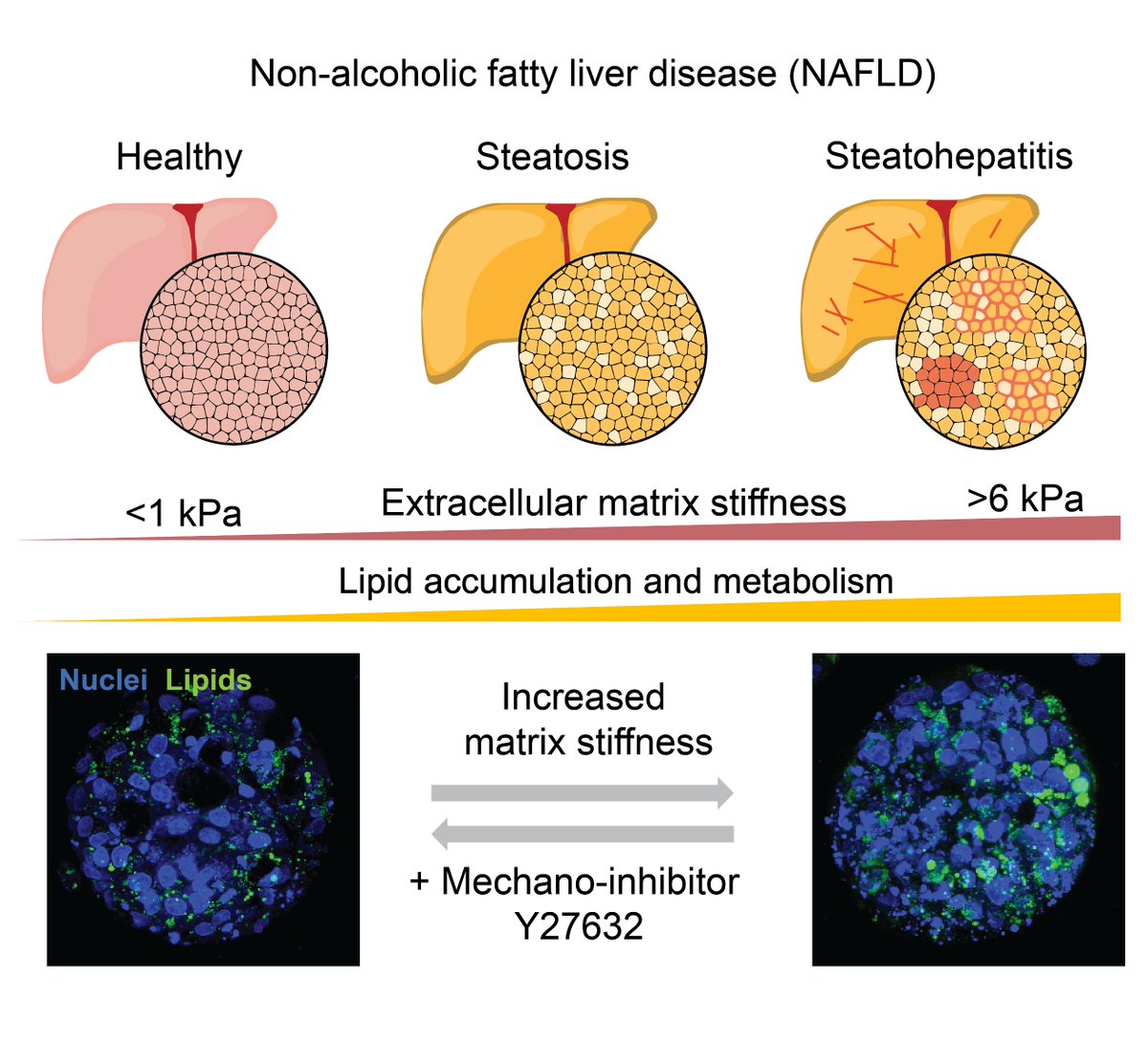 Heilshorn Lab (@heilshornlab) on Twitter photo We're delighted to share our new work out in Advanced Science, led by PhD student <a href="/Yueming_L/">Yueming Liu</a>! We develop an in vitro model of nonalcoholic fatty liver disease to study the role of mechanosignaling in disease progression. Congrats to all! <a href="/AdvPortfolio/">Advanced Portfolio News</a>
🔗 doi.org/10.1002/advs.2… We're delighted to share our new work out in Advanced Science, led by PhD student <a href="/Yueming_L/">Yueming Liu</a>! We develop an in vitro model of nonalcoholic fatty liver disease to study the role of mechanosignaling in disease progression. Congrats to all! <a href="/AdvPortfolio/">Advanced Portfolio News</a>
🔗 doi.org/10.1002/advs.2…