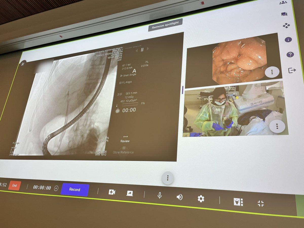 CU Division of Gastroenterology and Hepatology (@cugastrohep) on Twitter photo ✅#RMIE2025 prep day! <a href="/BilalMohammadMD/">Mohammad Bilal, MD</a> and #DrKusumaPokala are coming through crystal clear 💎- Tech test #1 complete for our EXCITING LIVE CASE transmissions! ✅ Early bird reg is open @ rmiecourse.com Sept 11-13! Reg today! ✅#RMIE2025 prep day! <a href="/BilalMohammadMD/">Mohammad Bilal, MD</a> and #DrKusumaPokala are coming through crystal clear 💎- Tech test #1 complete for our EXCITING LIVE CASE transmissions! ✅ Early bird reg is open @ rmiecourse.com Sept 11-13! Reg today!
