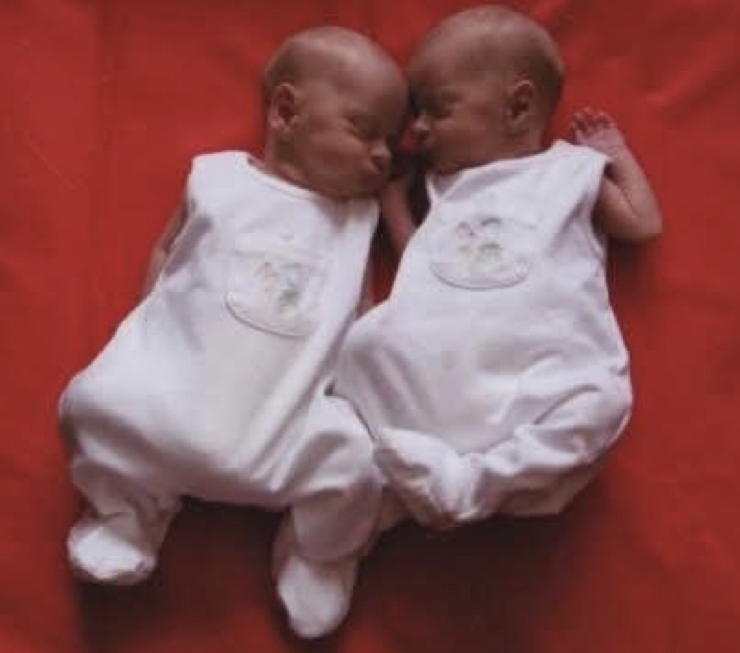 20 years ago today this pair came into my life 7 weeks premature. 18 months later diagnosed with a life limiting disease. They are now 13 years past their life expectancy and smashing it! #sma #twins #disability