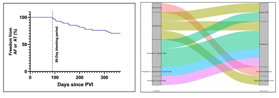 JICE (@jice_ep) on Twitter photo 🚨Newest #FreeRead Article in
<a href="/JICE_EP/">JICE</a>
One-Year Outcomes of Focal Pulsed-Field Ablation for Redo Procedures in Atrial Fibrillation and Atypical Flutter
🧐📖rdcu.be/eoiKj
by Emanuel Heil, Jin-Hong Gerds-Li, Matthias Bock, Frank Heinzel, <a href="/GerdHindricks/">Gerhard Hindricks</a> & <a href="/hohendanner_f/">Felix Hohendanner</a> 🚨Newest #FreeRead Article in
<a href="/JICE_EP/">JICE</a>
One-Year Outcomes of Focal Pulsed-Field Ablation for Redo Procedures in Atrial Fibrillation and Atypical Flutter
🧐📖rdcu.be/eoiKj
by Emanuel Heil, Jin-Hong Gerds-Li, Matthias Bock, Frank Heinzel, <a href="/GerdHindricks/">Gerhard Hindricks</a> & <a href="/hohendanner_f/">Felix Hohendanner</a>