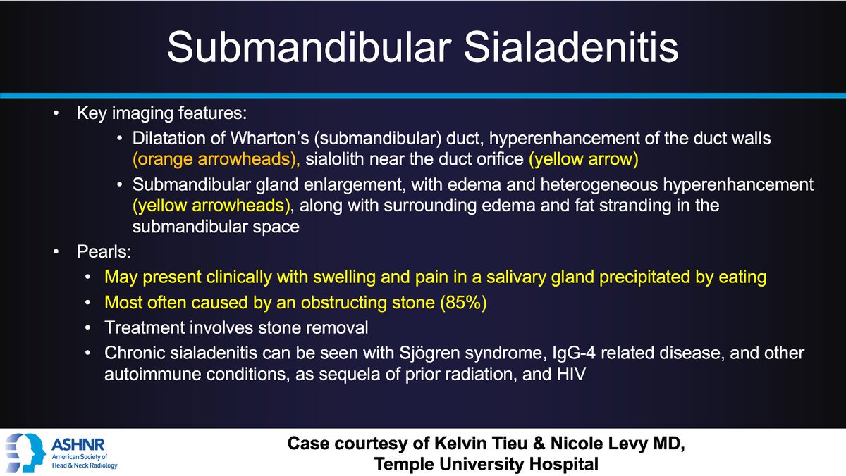 ASHNR (@ashnrsociety) on Twitter photo #ASHNRCOTW #299: ANSWER. Thx
Kelvin Tieu and Dr. Levy 4 case! #ASHNR25
<a href="/callyrobs/">Caroline Robson, MBChB</a> <a href="/DShatzkes/">Deborah Shatzkes</a> <a href="/CDP_Rad/">C Douglas Phillips 🇺🇸</a> <a href="/rhwiggins/">Richard Wiggins</a>
<a href="/nakoontz/">Nicholas Koontz</a> <a href="/KRileyMD/">Kalen Riley</a> <a href="/CMGlastonbury/">Christine M Glastonbury, MD</a> <a href="/tabby_kennedy/">Tabby A. Kennedy, MD</a> <a href="/PhilipRChapman1/">Philip R. Chapman, MD</a> <a href="/cmtomblinson/">Courtney Tomblinson, MD</a>
<a href="/amyfjuliano/">Amy Juliano</a> <a href="/bpoliceni/">Bruno Policeni</a> <a href="/MohitTCCNeuro/">Mohit Agarwal</a>
<a href="/AshokSrini15/">Ashok Srinivasan</a> <a href="/KatieTraylorDO/">Katie S. Traylor MS, DO, DABR</a> <a href="/CynXinWu/">Cynthia Xin Wu</a> #ASHNRCOTW #299: ANSWER. Thx
Kelvin Tieu and Dr. Levy 4 case! #ASHNR25
<a href="/callyrobs/">Caroline Robson, MBChB</a> <a href="/DShatzkes/">Deborah Shatzkes</a> <a href="/CDP_Rad/">C Douglas Phillips 🇺🇸</a> <a href="/rhwiggins/">Richard Wiggins</a>
<a href="/nakoontz/">Nicholas Koontz</a> <a href="/KRileyMD/">Kalen Riley</a> <a href="/CMGlastonbury/">Christine M Glastonbury, MD</a> <a href="/tabby_kennedy/">Tabby A. Kennedy, MD</a> <a href="/PhilipRChapman1/">Philip R. Chapman, MD</a> <a href="/cmtomblinson/">Courtney Tomblinson, MD</a>
<a href="/amyfjuliano/">Amy Juliano</a> <a href="/bpoliceni/">Bruno Policeni</a> <a href="/MohitTCCNeuro/">Mohit Agarwal</a>
<a href="/AshokSrini15/">Ashok Srinivasan</a> <a href="/KatieTraylorDO/">Katie S. Traylor MS, DO, DABR</a> <a href="/CynXinWu/">Cynthia Xin Wu</a>