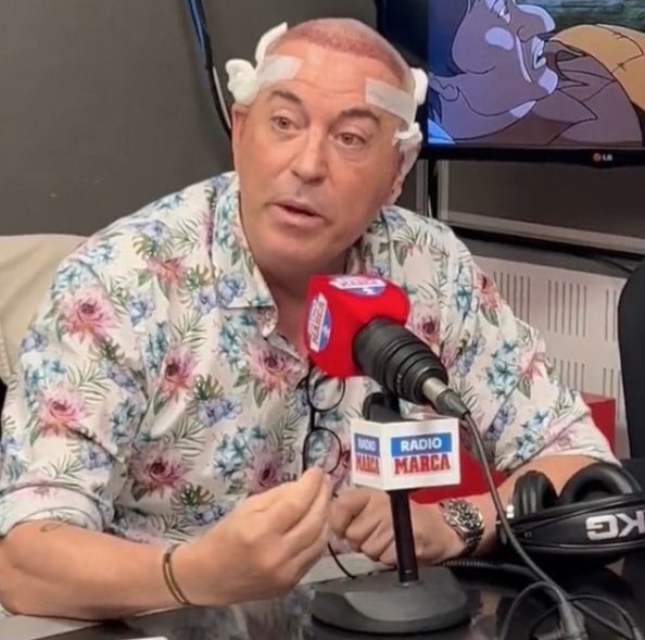 FausGonzlez's tweet photo. @garc_gabi Creo que solo Pipi Estrada conocía la verdad. De hecho, era tal el conocimiento de Pipi, que el mismísimo Pedro Sánchez ordenó una cirugía craneoencefálica para inhabilitar al notablísimo periodista gijonés, al punto de que ahora es jodidamente retrasado. https://t.co/Rm6CdOtQdu