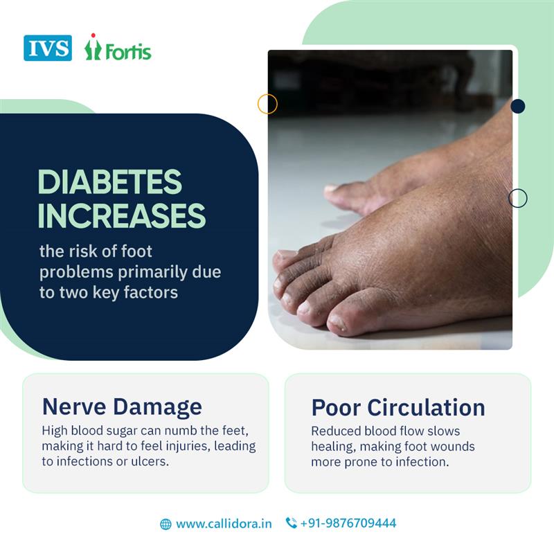 callidora_laser's tweet image. Diabetes can silently impact your feet—don’t wait for problems to show up. Regular checks and the right care can make all the difference!
bit.ly/3ULougB
#Foothealth #damagednerves #poorbloodcirculation #diabetes #footcare #diabeticfoot