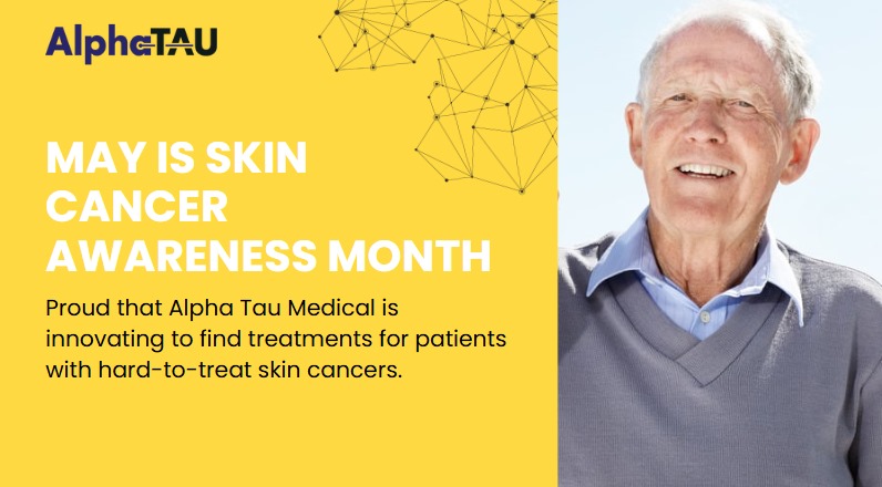 🌞 May is #SkinCancerAwareness Month!
Early detection is key, but new treatments are also changing the game.
We’re innovating with #AlphaDaRT®, designed as a single-session, targeted therapy for skin tumors, currently available only in clinical trials.