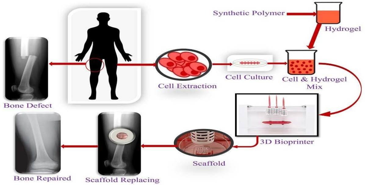 Bioeng_MDPI's tweet image. 🔬 Excited to share the publication "Three-Dimensional Scaffolds for Bone Tissue Engineering".

Welcome to access the full article freely here 👉 mdpi.com/2306-5354/10/7…

#tissue_engineering #bone #grafts #autograft #allograft #xenograft #hMSCs #bioprinting #freezing