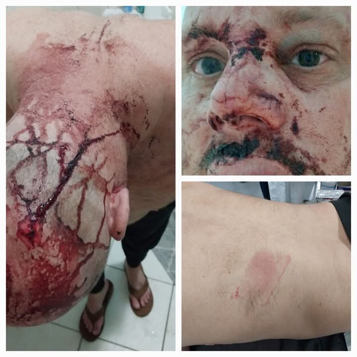 Stop white Genocide tweet media