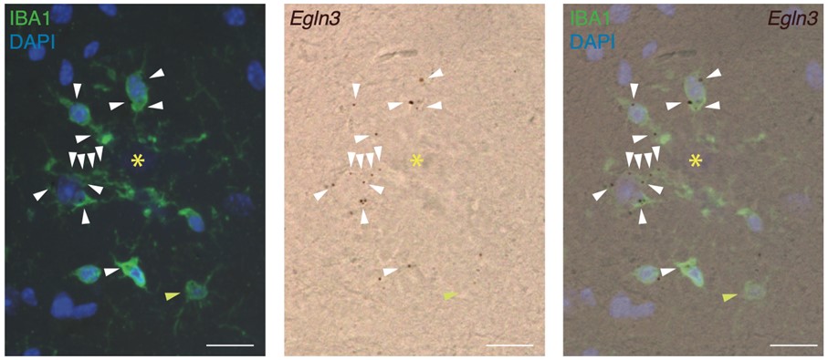 🔴NEWS |

"Una investigación del #IBiS identifica una nueva diana para el tratamiento del #Alzheimer"

Noticia completa ➡️ibis-sevilla.es/es/noticias/in…