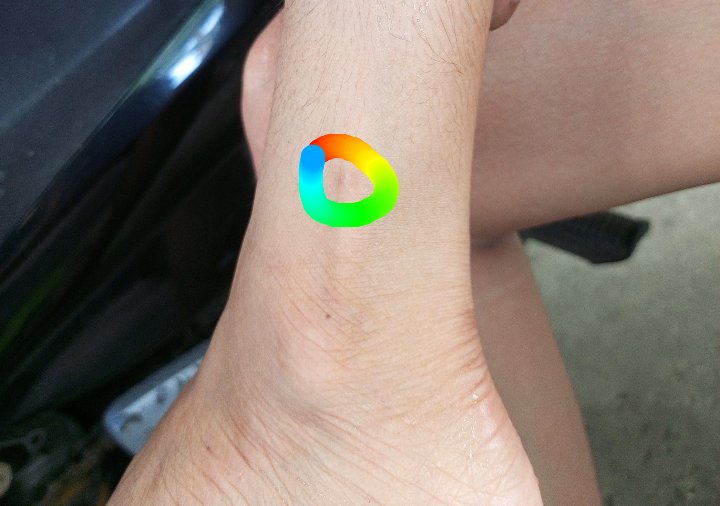 Nung May 12 Elec. Day, bigla na lang po ako inatake ng pusa namin, I was sitting sa labas ng bahay namin while nag cellphone ng bigla na lang po ako nakaramdam ng sakit at pagtingin ko sa paa ko dumogo na po. Hindi ko po alam kung kinagat or kinalmot ng pusa namin kasi diko+