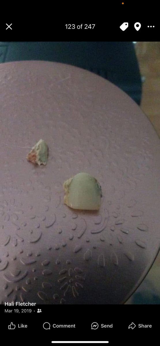 WSOMostHated's tweet photo. The tooth in my living room on a bath &amp; body works candle after I knocked SB tooth out @GottiJas  why lie https://t.co/5NI1io4JRA