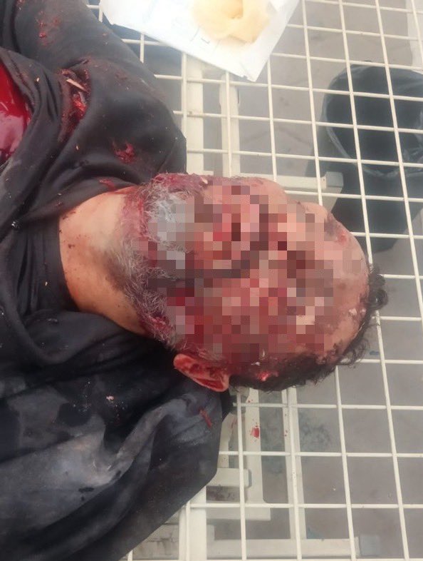 The israelis murder another highly-skilled doctor in a targeted strike on Sarari Street in Jabalia al-Balad, north of Gaza City, Dr Ahmed Nabhan