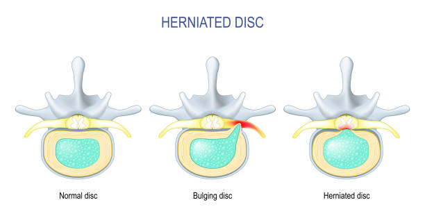 👉"SÍNDROME DE BERTOLOTTI"🩻🩺🔬🦴🦵💪

✅elblogdeldolor.com/2025/05/18/sin…

🌐Hoy #DiaMundialdelaSaludDigestiva en #ElBlogdelDolor ¡Gracias x leer y Rp!