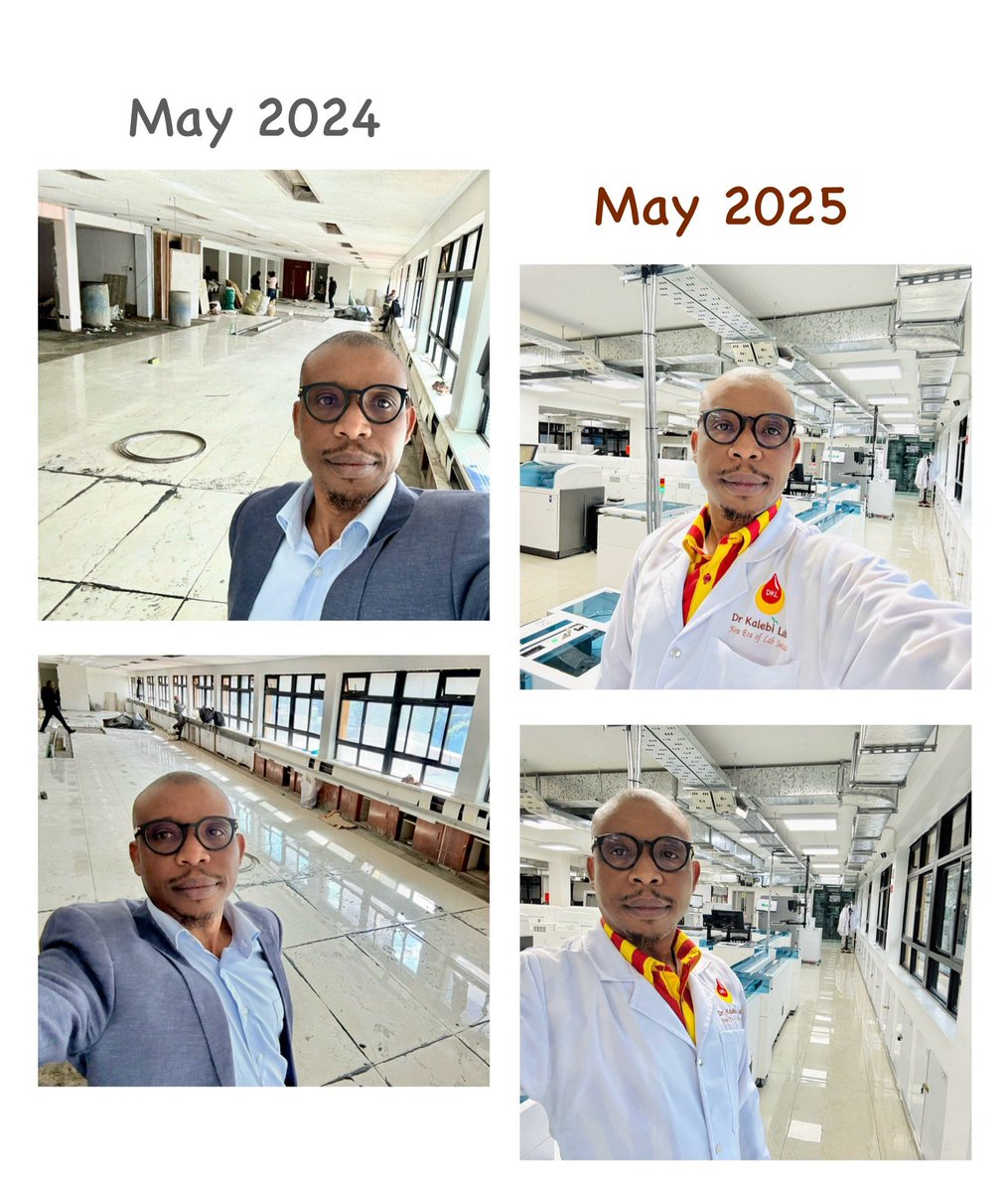 ๐๐ฟ ๐๐ต๐บ๐ฒ๐ฑ ๐๐ฎ๐น๐ฒ๐ฏ๐ถ, ๐๐พ๐ (@drahmedkalebi) on Twitter photo Celebrating a most remarkable homegrown progress ๐ ๐ฃ๐ต๐ผ๐๐ผ๐ ๐ญ ๐๐ฒ๐ฎ๐ฟ ๐ฎ๐ฝ๐ฎ๐ฟ๐! THEN: 29 May 2024, flooring work had commenced at the lab site. NOW: 29 May 2025, lab up & running since Oct 2024, ISO15189 accredited since Dec 2024!
โฉ๏ธ ๐๐
It does feel surreal at Celebrating a most remarkable homegrown progress ๐ ๐ฃ๐ต๐ผ๐๐ผ๐ ๐ญ ๐๐ฒ๐ฎ๐ฟ ๐ฎ๐ฝ๐ฎ๐ฟ๐! THEN: 29 May 2024, flooring work had commenced at the lab site. NOW: 29 May 2025, lab up & running since Oct 2024, ISO15189 accredited since Dec 2024!
โฉ๏ธ ๐๐
It does feel surreal at