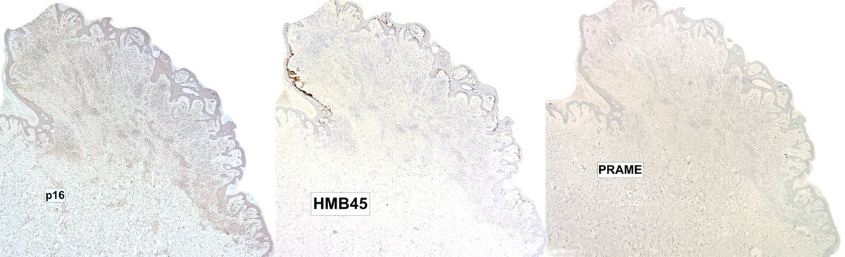 Francesco Fortarezza tweet media