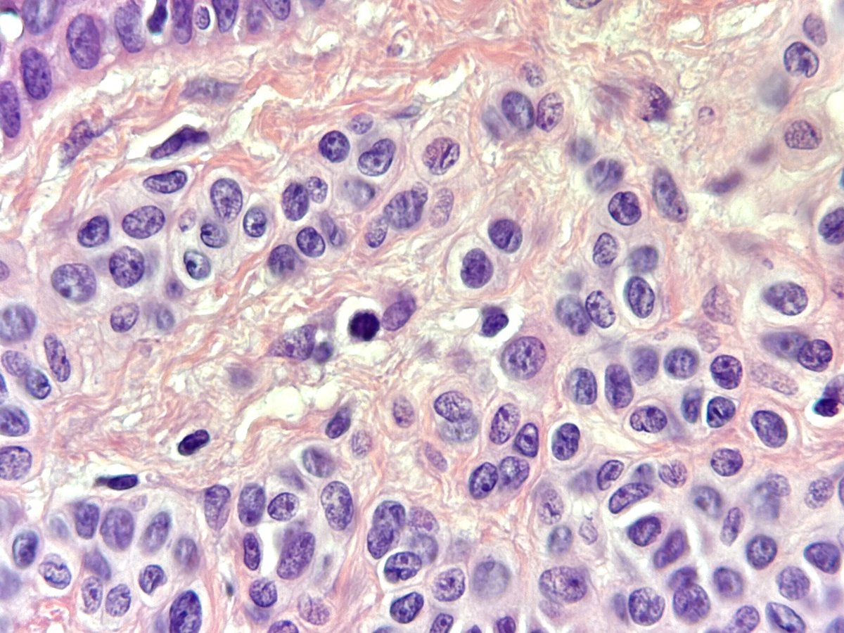 Francesco Fortarezza tweet media