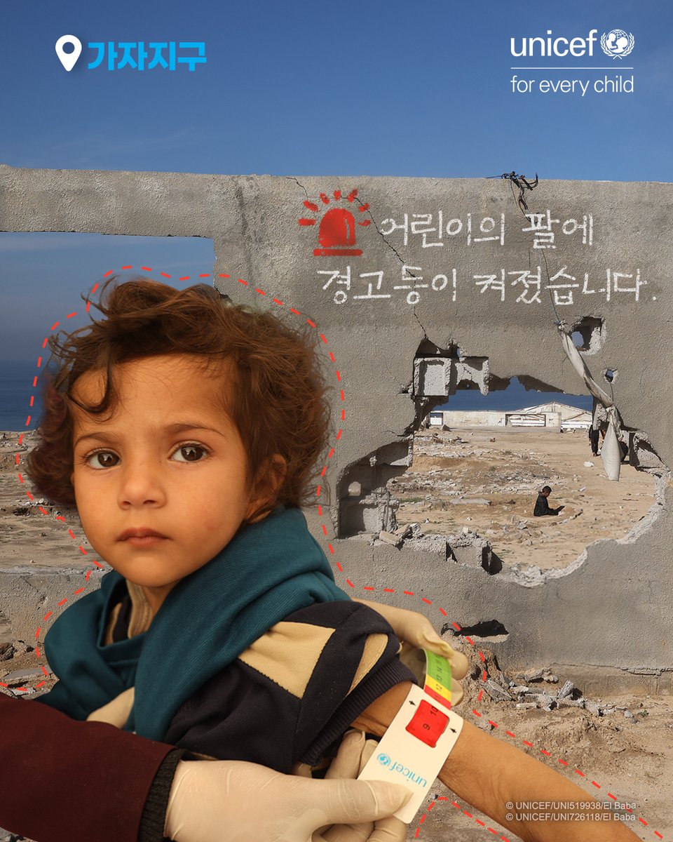 #가자지구 어린이의 팔에 둘러진
영양실조 진단 팔찌(MUAC 테이프)는
어린이가 얼마나 더 버틸 수 있을지
경고하고 있습니다.

현재 가자지구 어린이 약 47만 명이
기아 수준의 위기에 놓여 있습니다.

#유니세프 는 영양보충제 10만 팩을 전달하고,
이후 100만 명이 4개월 간 버틸 수 있는
식량을