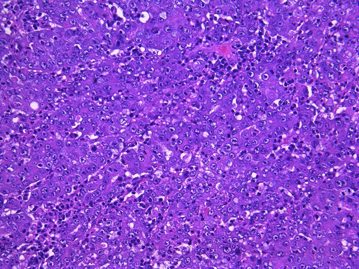 Pathology Walker@Auto Tweet Bot tweet media