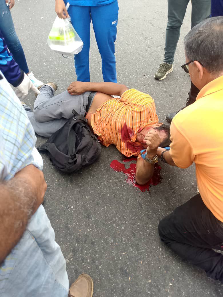 Birrilly's tweet image. (((ACCIDENTE))) #Bolivar #Motorizado arrolló a un apersona a la altura del #Semaforo del #CentroComercial #Narayan #CiudadAltavista #PuertoOrdaz, los dos están heridos fueron atendidos y trasladados a un centro de salud @ReporteYa @albertoprato02 @traficovv @PableOstos @eldiario