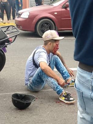 Birrilly's tweet image. (((ACCIDENTE))) #Bolivar #Motorizado arrolló a un apersona a la altura del #Semaforo del #CentroComercial #Narayan #CiudadAltavista #PuertoOrdaz, los dos están heridos fueron atendidos y trasladados a un centro de salud @ReporteYa @albertoprato02 @traficovv @PableOstos @eldiario