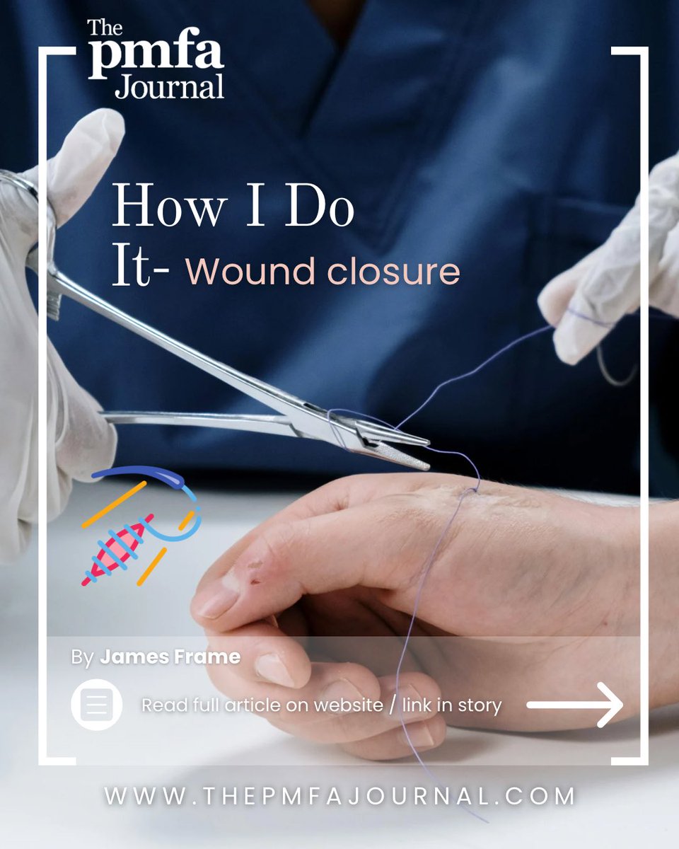 The PMFA Journal (@pmfajournal) on Twitter photo Where you make your incision MATTERS! ๐งต Prof ๐๐๐ฆ๐๐ฌ ๐
๐ซ๐๐ฆ๐ reveals why natural skin creases โ Langer's lines.
โจ Key tip: Follow lines of least resistance to motion!
โ Have you seen complications from poorly placed incisions?
๐Full article:thepmfajournal.com/education/how-โฆ Where you make your incision MATTERS! ๐งต Prof ๐๐๐ฆ๐๐ฌ ๐
๐ซ๐๐ฆ๐ reveals why natural skin creases โ Langer's lines.
โจ Key tip: Follow lines of least resistance to motion!
โ Have you seen complications from poorly placed incisions?
๐Full article:thepmfajournal.com/education/how-โฆ