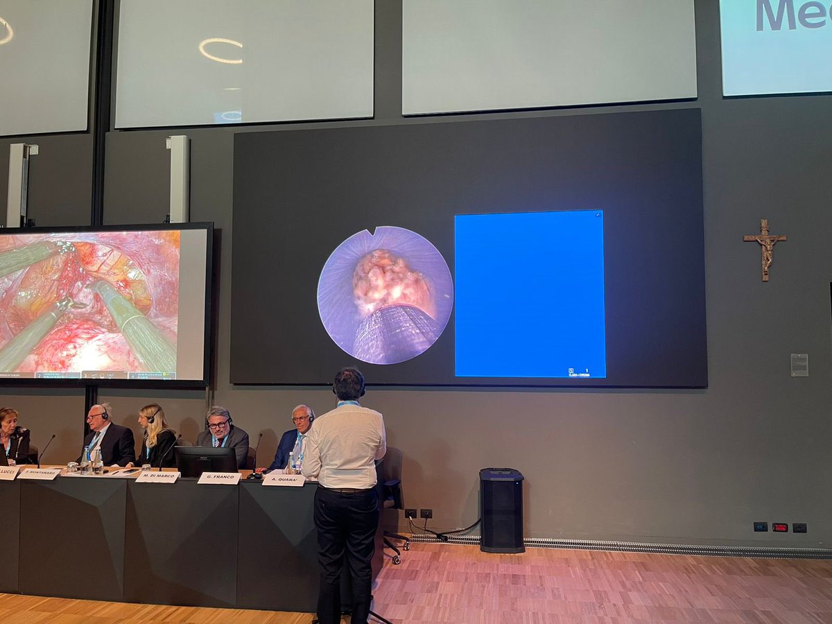 Guido Giusti (@guidogiusti) on Twitter photo What a satisfaction to perform such a tricky #supinePCNL within 24th Congress of Italian Endourological society in Rome @ Campus Biomedico … this has been the demonstration of how important is teamwork in #endourology with <a href="/sproietti81/">Silvia Proietti</a> <a href="/_FDeLeonardis/">Federico De Leonardis</a> & also local Team Dr. What a satisfaction to perform such a tricky #supinePCNL within 24th Congress of Italian Endourological society in Rome @ Campus Biomedico … this has been the demonstration of how important is teamwork in #endourology with <a href="/sproietti81/">Silvia Proietti</a> <a href="/_FDeLeonardis/">Federico De Leonardis</a> & also local Team Dr.