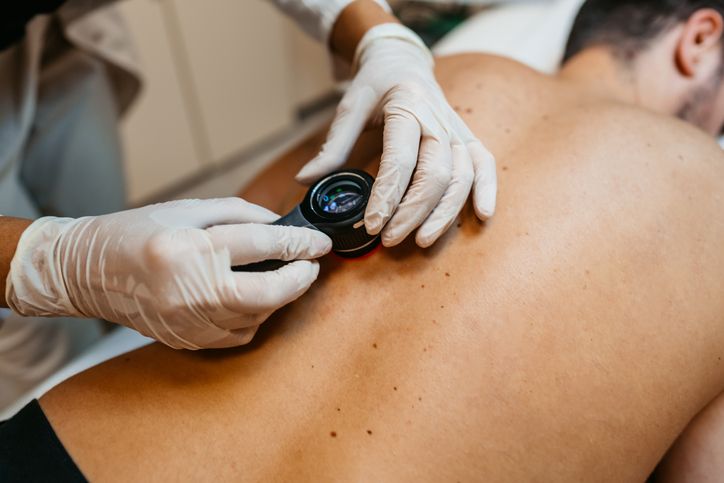 mydocwire's tweet image. #ASCO25 🩺  
📊 New data highlight clinical predictors of early #cutaneousmelanoma recurrence.  
📈 Key variables may guide post-treatment surveillance and decision-making.  
🔗 buff.ly/dznq8Ka  
#Melanoma #Oncology #CancerRecurrence #ClinicalResearch #SkinCancer #DermOnc
