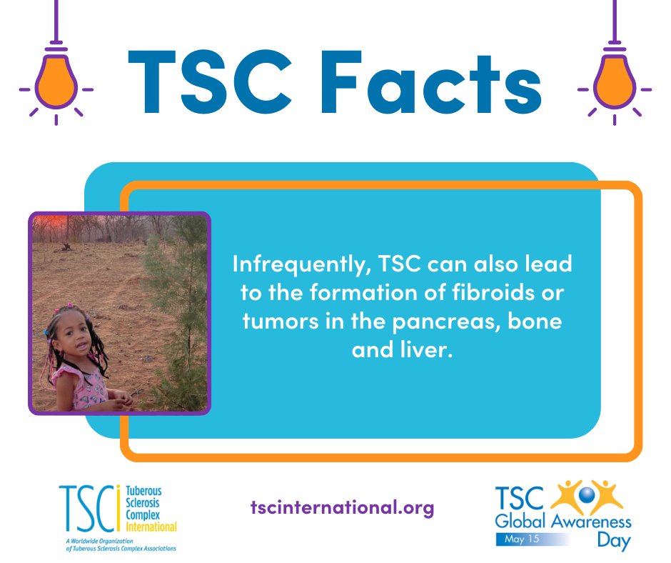 ⭐Day 29 of TSC Awareness Month! ⭐

Infrequently, TSC can also lead to the formation of fibroids or tumors in the pancreas, bone and liver.

Learn more about TSC Global Awareness initiatives at tscglobalday.org.

#tscglobalawarenessday #tuberoussclerosiscomplex