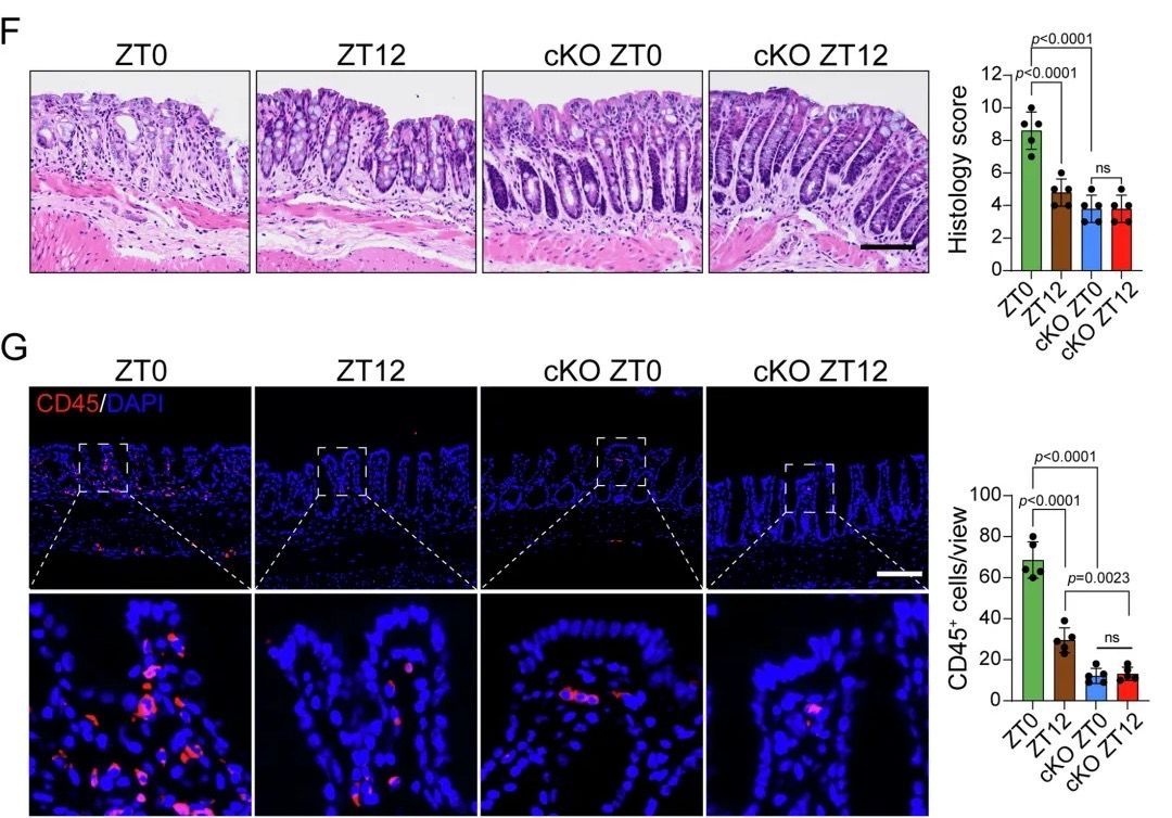 Tsinghua_Uni's tweet photo. Gut check: How’s yours doing? This #WorldDigestiveHealthDay, #InnovativeTsinghua reveals circadian #apoptotic rhythms in mice intestinal lining and Bmal1’s role in gut repair, highlighting how the Bmal1-centered #CircadianClock repairs intestinal injury! For more: https://t.co/jqwgniPFQj