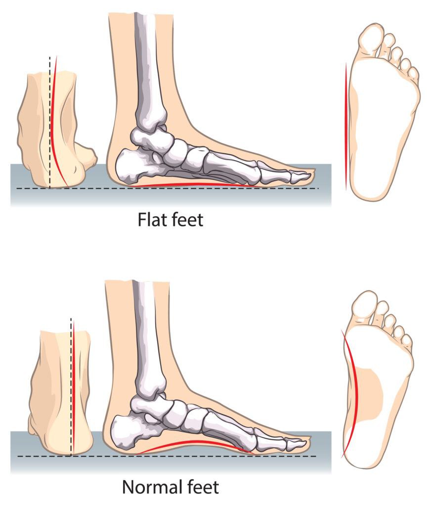 GodswillChemist's tweet photo. The footwear industry is misleading you.

You’re dropping $200 on brands like:

• Nike
• Puma
• Adidas

…while they quietly damage your feet and alignment long-term.

How these shoes affect your body—and healthier alternatives: https://t.co/fhMD1vDRK9